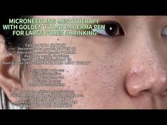 Anti-Aging Microneedling& Collagen Boost Pen with LED Light Therapy & Microcurrent-Tightening, Lifti